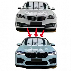 Facelifts